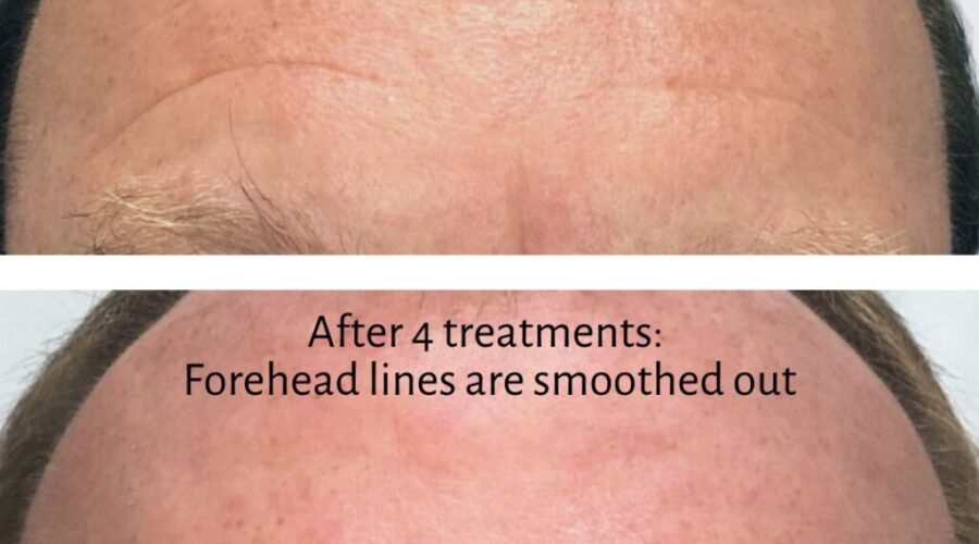 10 Best Botox in Your 20s vs. 30s vs. 40s: What Top US Med Spas Recommend Neighborhoods